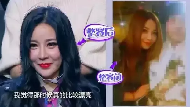 “网红脸”审美毁掉了多少中国女孩 4