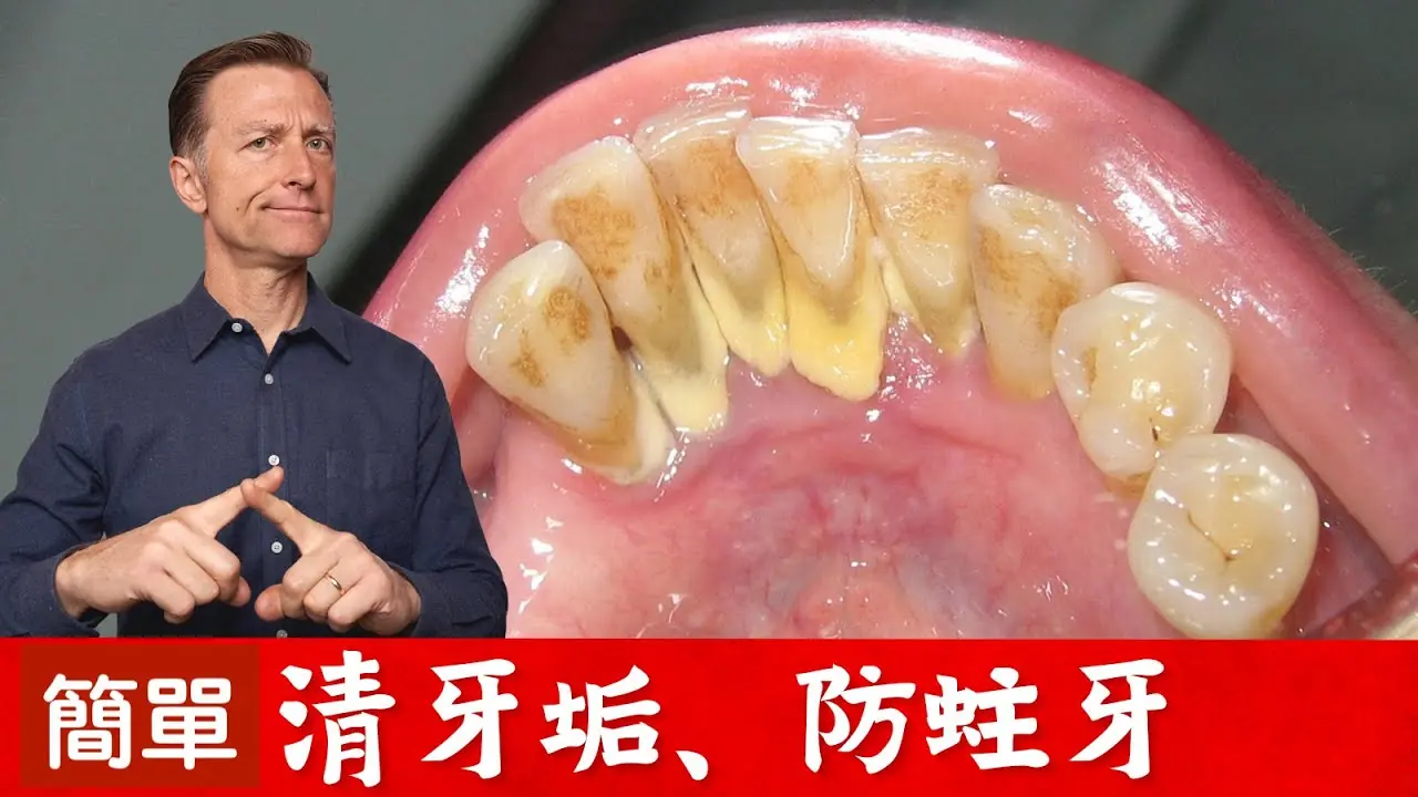 牙垢太多怎么办？三种天然方法去除牙菌斑！