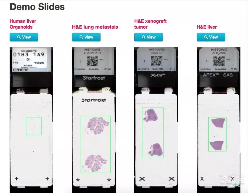 传统病理学发展太慢HistoWiz 想在云上搭建全球最大的癌症数据库 2