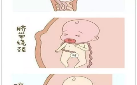 孕妇产前知识大全