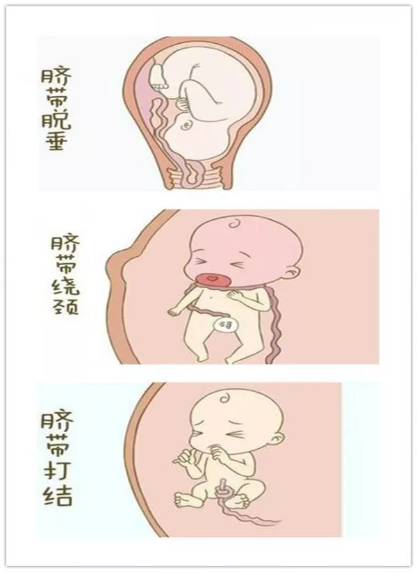 孕妇产前知识大全 1