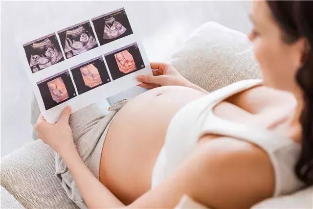 孕妈妈涨知识：孕期B超检查单该怎么看？ 4