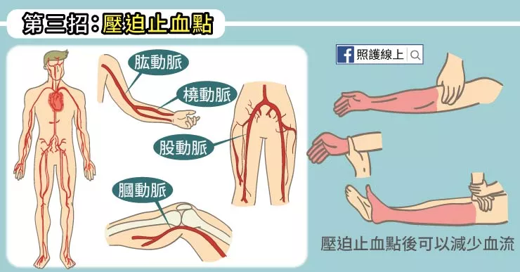 学会这3招受伤流血不要慌！ 2