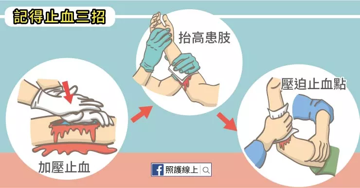 学会这3招受伤流血不要慌！ 3