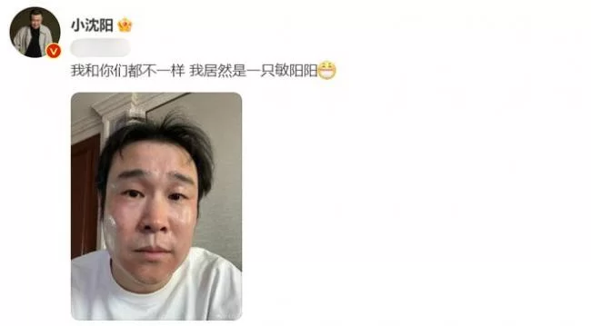 小沈阳也阳了脸部红肿胖了一大圈